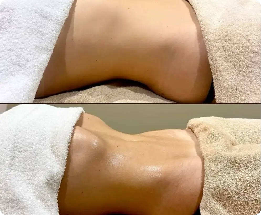 Belly & Waist Sculpting