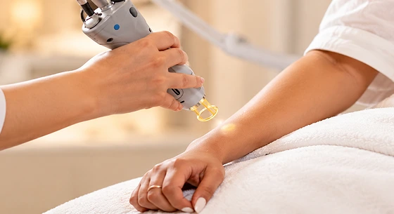 Laser Hair Removal in Chennai Cost, Benefits, Results & Reviews